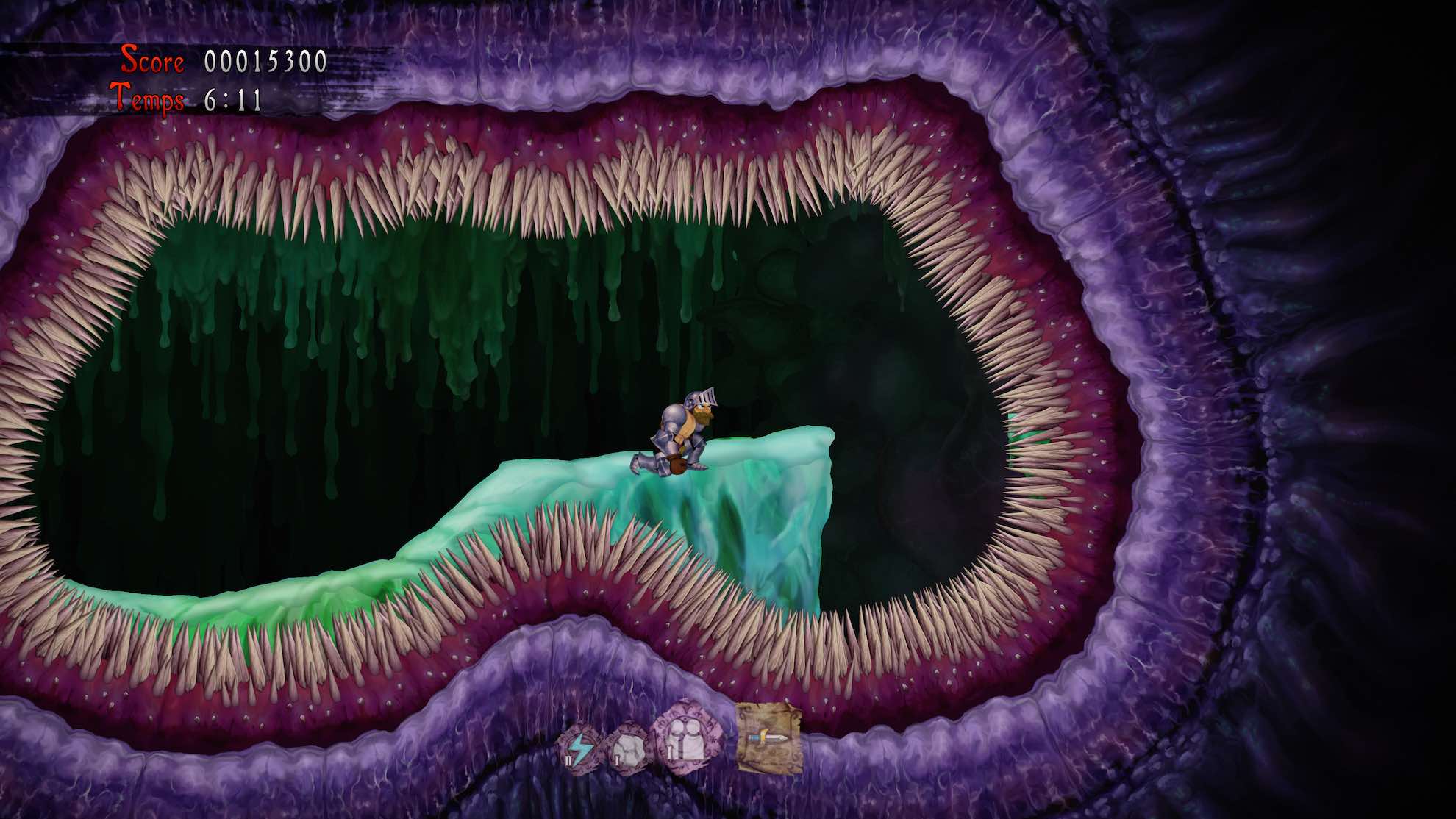 Une bouche ou un colon denté ?
